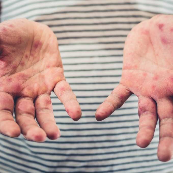 Texas Biohazard & Trauma Cleanup Services